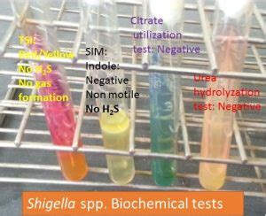 shigella sonnei biochemical test results|Shigella: Disease, Properties, Pathogenesis, Lab Diagnosis.